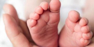 الكشف عن19مرضًا وراثيًا لدى الأطفال المبتسرين داخل الحضانات